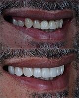 Tratamientos en 7 días