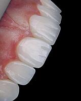 Detalles especializados