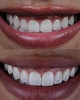 La sonrisa que has soñado