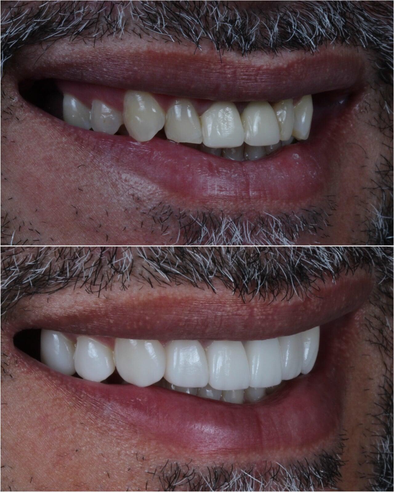 Tratamientos en 7 días