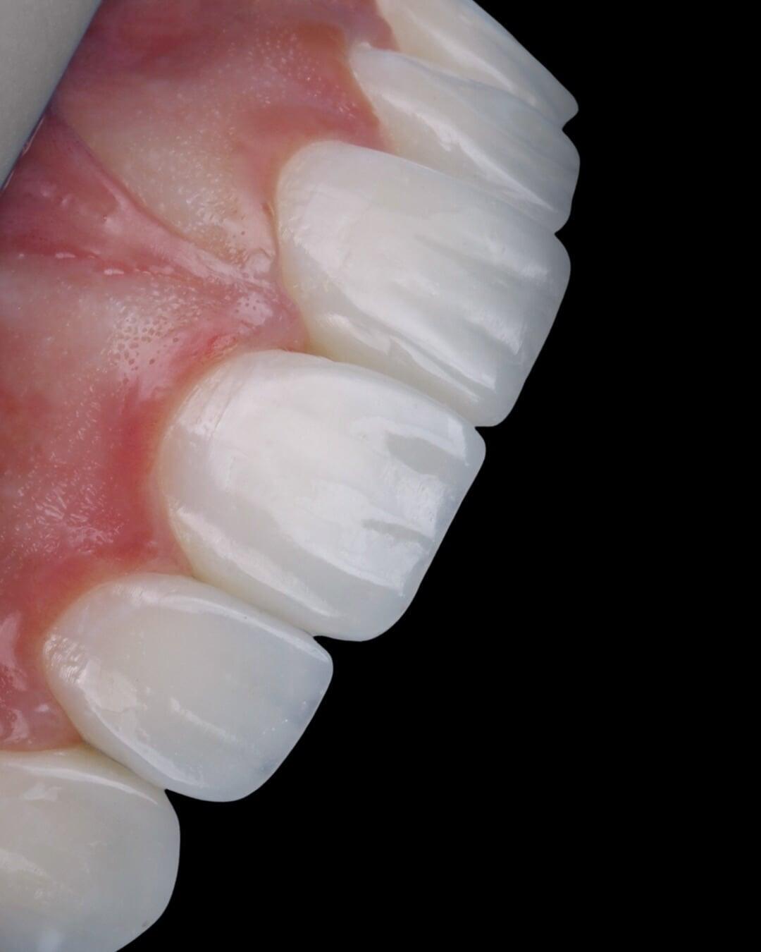 Detalles especializados