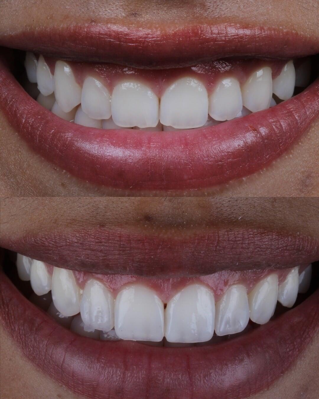 La sonrisa que has soñado