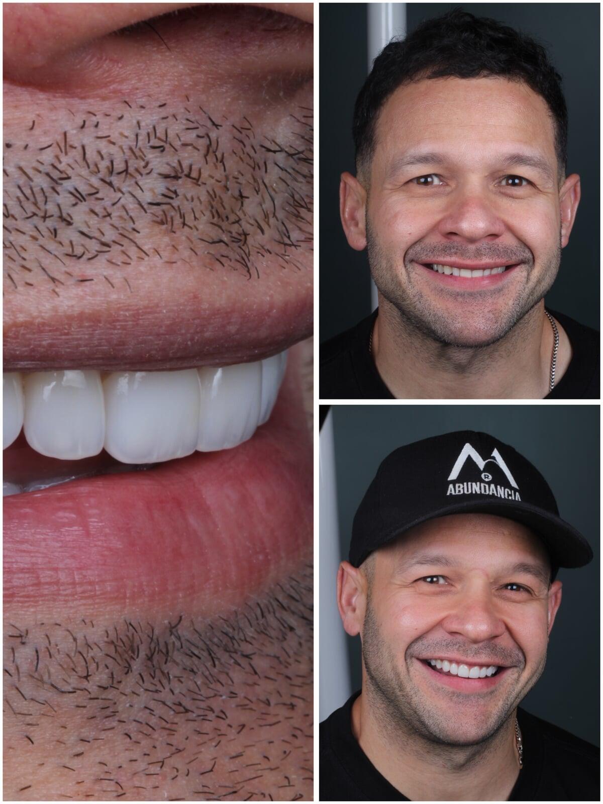 Resultados más naturales